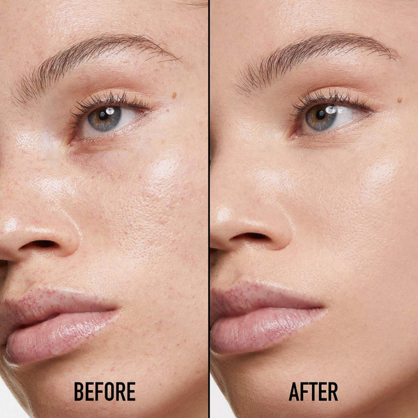 Консиллер Dior Forever Skin Correct, оттенок - 1.5N, 11мл  366-20b фото